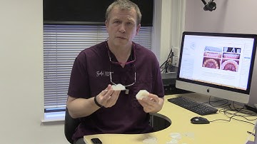 Dr Ian Buckle on toothwear - a predictable workflow for predictable results