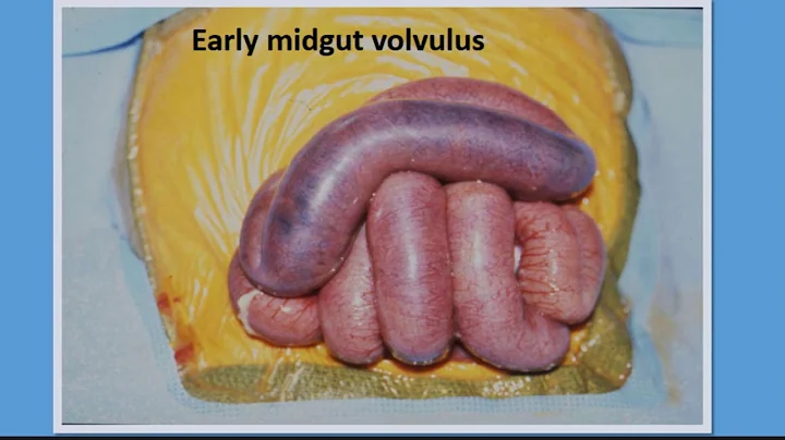 "Abdominal Pain in Children", Lesli Taylor, MD