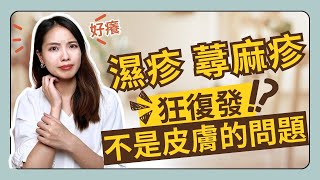 濕疹蕁麻疹反覆爆發是身體的求救訊號Nina蕭業力身心轉化室