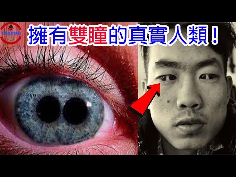 [TOP5]數個擁有不凡之眼的人類 | 真實的雙瞳與血紅之眼 | 30天不眨眼的嚇人後果