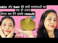 🥰1Month Challenge ले कर तो देखिए👍 Skin और Hair की सारी समस्याओं का होगा समाधान॥