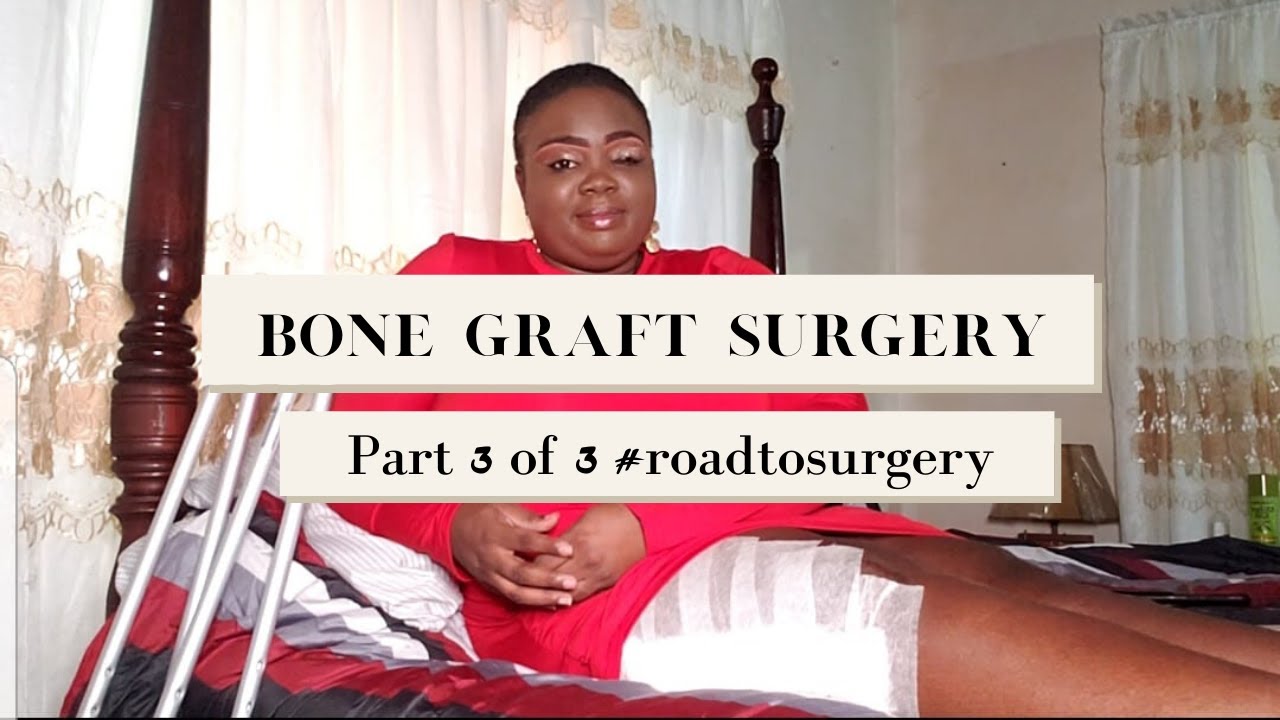 How I use BONE GRAFT SURGERY to fix my BROKEN FEMUR (Part 3 of 3) YouTube