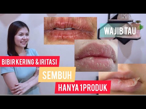 Video: 13 Cara Mengobati dan Mencegah Bibir Kering atau Pecah-pecah