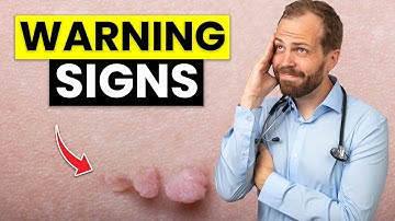 Skin Tags: What Do They REALLY Mean? (Don