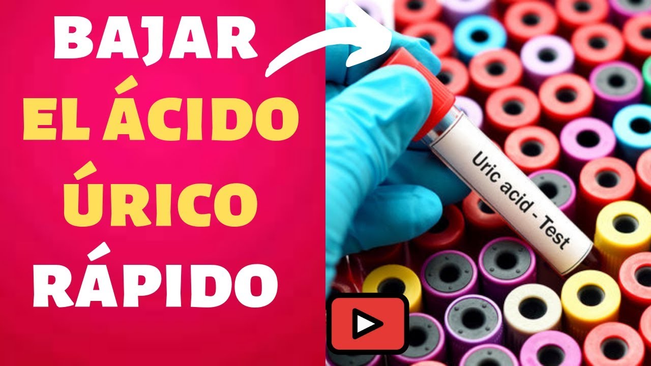 acido urico en suero