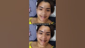 I guess I still look like a teenager lol #babyface #younglook #filter