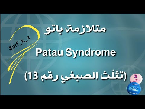 متلازمة باتو Patau Syndrome(تثلّث الصبغي رقم 13)