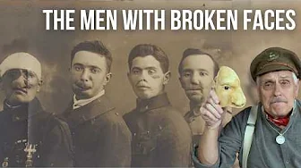 Transforming Faces | World War 1 and the birth of modern plastic surgery