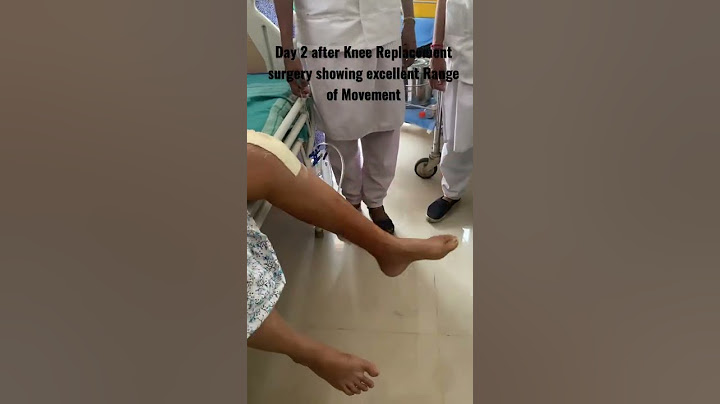 Recovery after Knee Replacement Surgery - Dr Ganesh (7558879607)