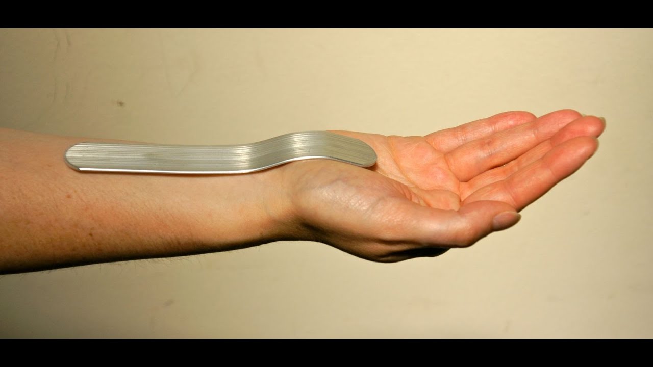 Manhid Ang Kamay (Carpal Tunnel Syndrome) - Dr Willie Ong Tips #1 (in Filipino)