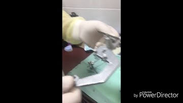 Mounting maxillary cast