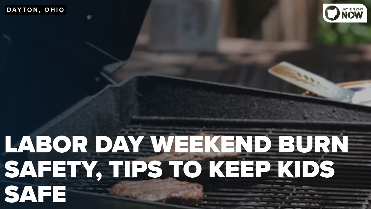Hot grills, little hands: Preventing Labor Day Burns