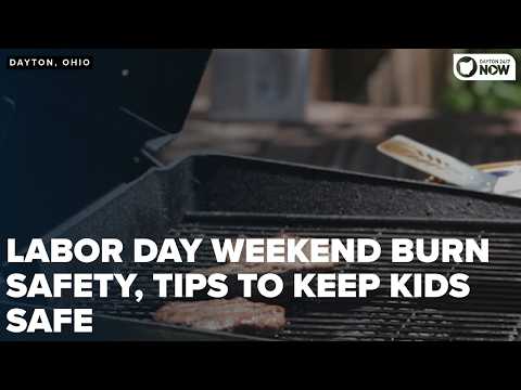 Hot grills, little hands: Preventing Labor Day Burns