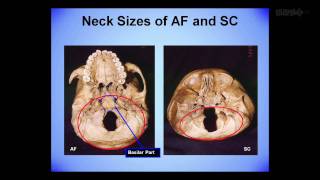 Lloyd Pye - The Starchild Skull Enigma Part 38