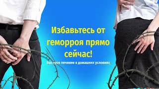 Геморект - гель от геморроя! Лечение геморроя в домашних условиях