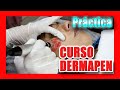 🔴 DERMAPEN | CURSO GRATIS 2021🏆 : Demostración paso a paso Dr. Sergio Zerpa MICRONEEDLING TUTORIAL