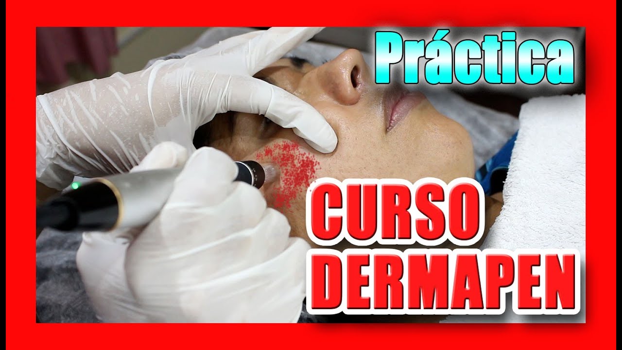 🔴 DERMAPEN | CURSO GRATIS 2021🏆 : Demostración paso a paso Dr. Sergio Zerpa MICRONEEDLING TUTORIAL