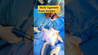 ACL+MCL Surgery🔥Multi-ligament Knee Surgery #acl #aclinjury #aclrecovery #mcl #ligament#ligamenttear