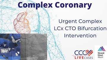 Urgent Complex LCx CTO Bifurcation Intervention