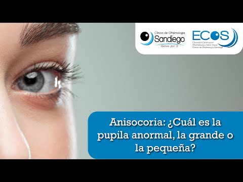 Anisocoria: ¿Cuál es la pupila anormal, la grande o la pequeña?