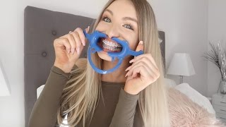 6 Month Braces Update D Wires???