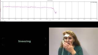 Artifacts in EEG demo (English subtitled)