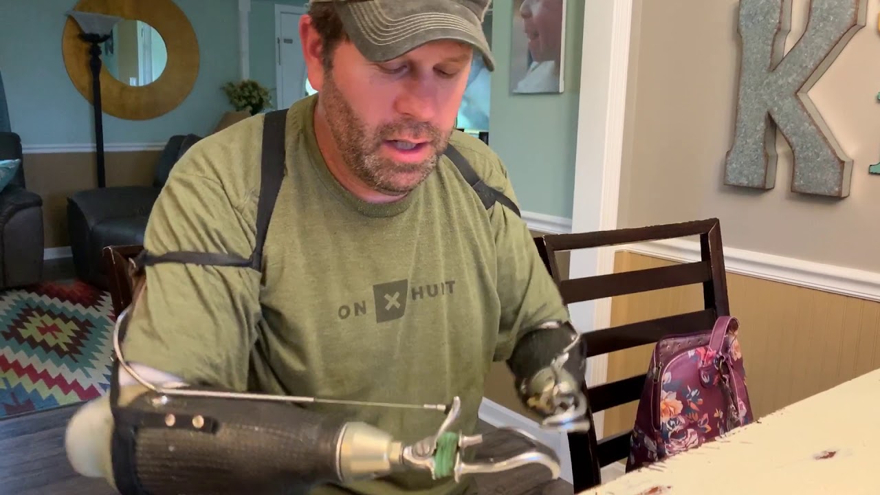 Jason Koger bilateral arm amputee show how to use fork and knife with body powered prostheses