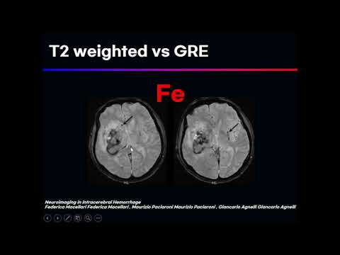 T2 weighted image(clinical)