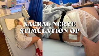 Sacral Nerve Stimulation - Fowler&#39;s Syndrome