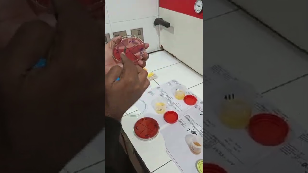 Urine Culture and Sensitivity Test | Urine for C/S 