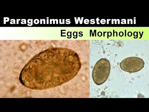 Paragonimus Westermani Eggs Morphology