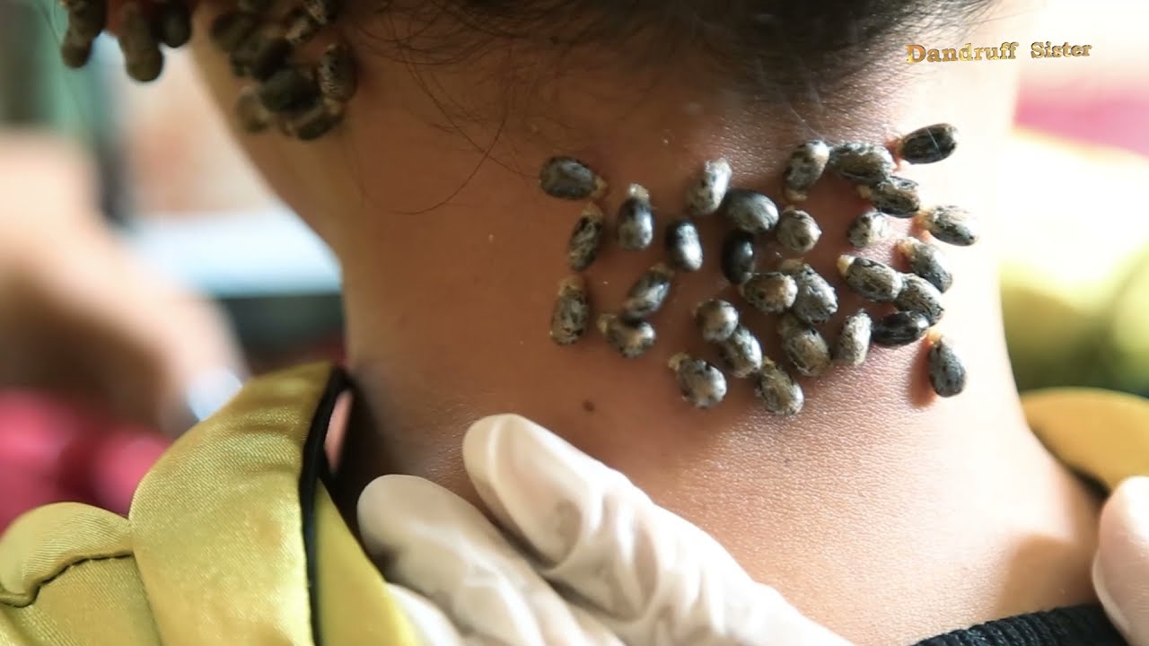 Best Tip to Clean your Neck #285