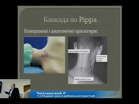 Реґіонарна анестезія при оперативних втручаннях на плечовому суглобі і ключиці. Чаплинський Р.