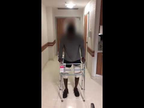 Patient from USA: walking after LON femur lengthening surgery