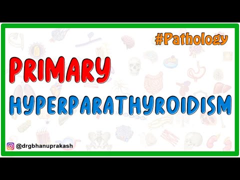 Primary Hyperparathyroidism - Etiology , Pathogenesis , Pathology , Diagnosis and Treatment