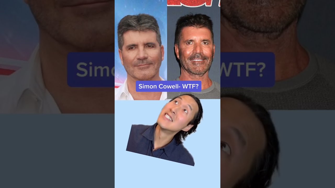 Shocking Male Plastic Surgery Transformations 