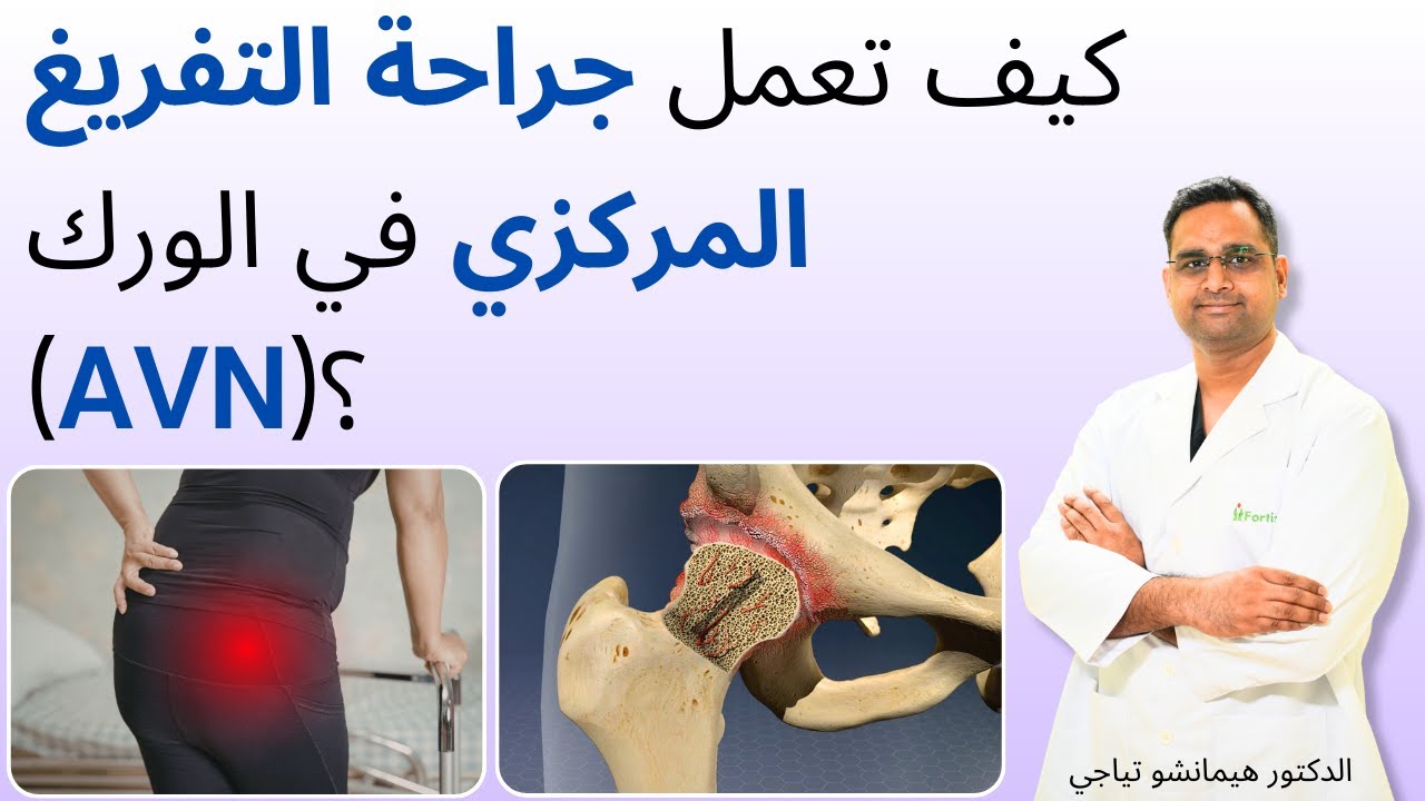 كيف تعمل جراحة التفريغ المركزي في الورك (AVN)؟ | Core Decompression surgery in Arabic