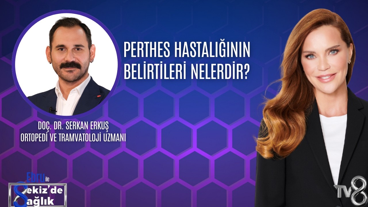 PERTHES HASTALIĞININ BELİRTİLERİ NELERDİR? | DOÇ. DR. SERKAN ERKUŞ | 8'de Sağlık