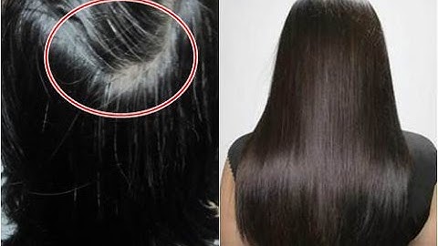 Ai Mắc Chứng TÓC BẠC SỚM Thì Xem Video Này, Bạn Sẽ Mừng RƠI NƯỚC MẮT Vì Tóc Đen Và Suôn Mượt Trở Lại