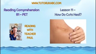 B1 Reading Comprehension | PET Practice - Lesson 11 - How Do Cuts Heal