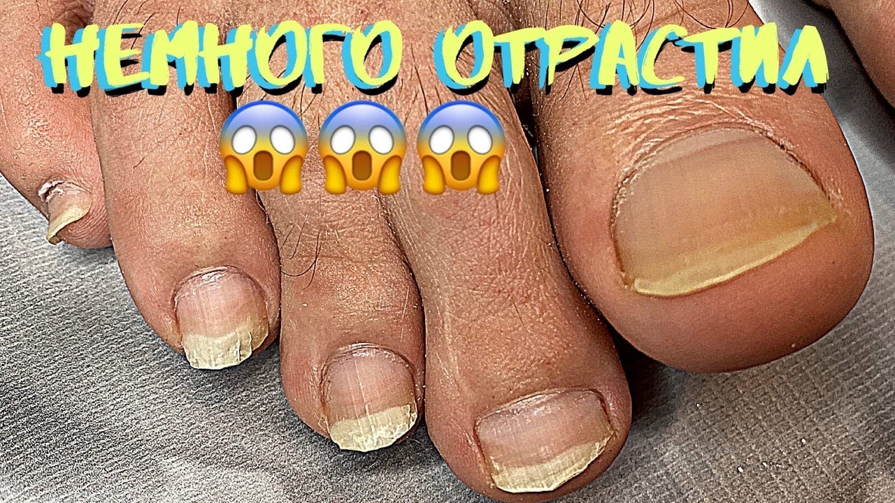 Мужской педикюр | Длину Убираем?😂  ❌Что не нужно делать❌ Сильно отличается от женского?