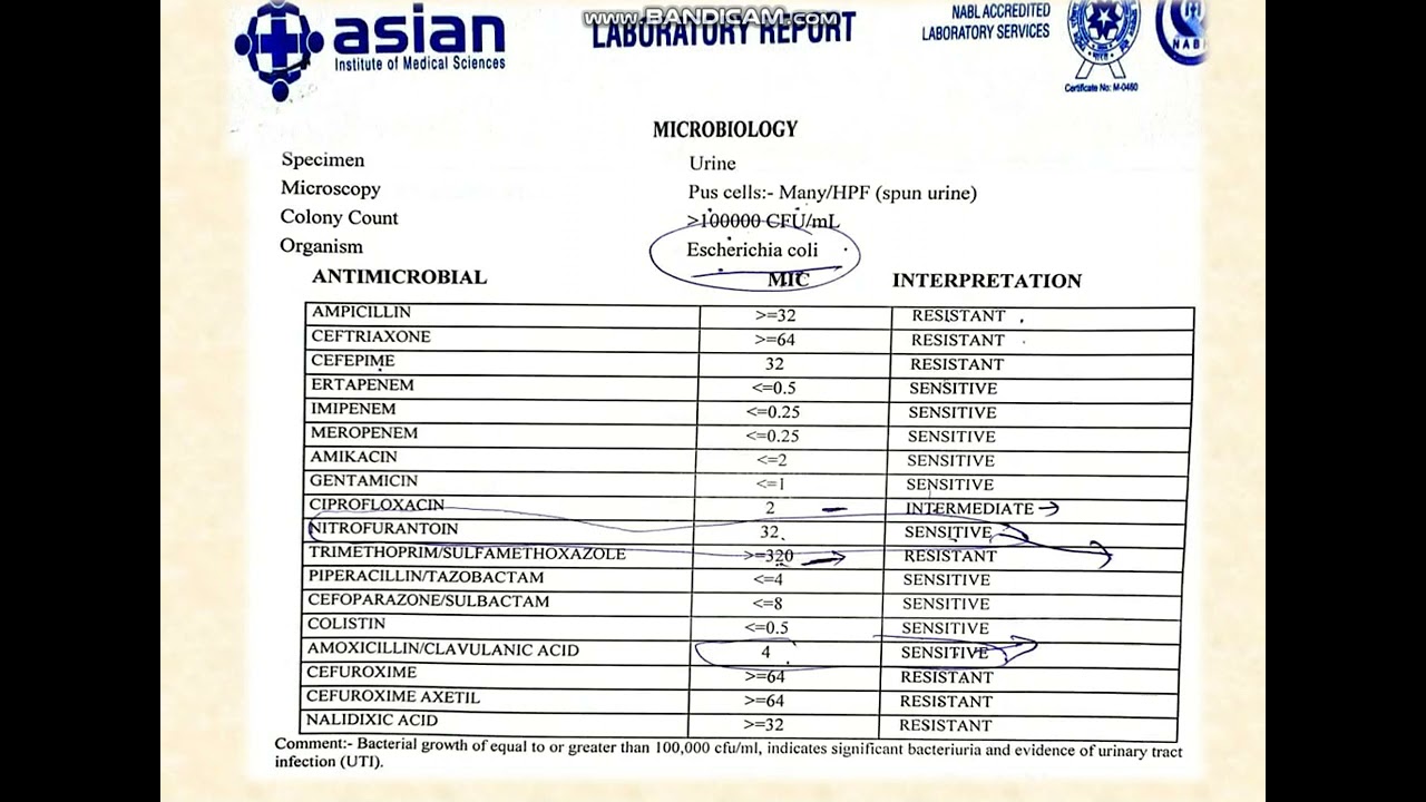 Urine Culture And Sensitivity Test urineculturetest And Urine Culture And Sensitivity Test urineculturetest And