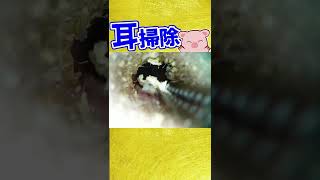 【使用した耳かき道具は概要欄】耳掃除：１カ月ぶりはデカし！子供の耳かき/Ear cleaning