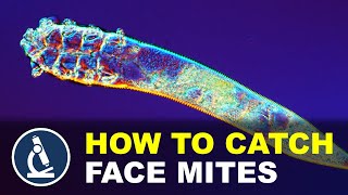 I show you an easy way to catch FACE MITES from your eyes | DEMODEX