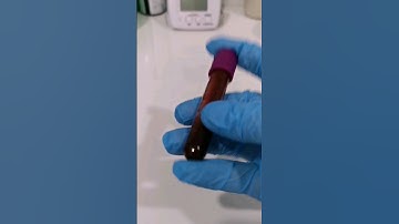 Life inside the Laboratory #medtechlife #laboratorylife #medtechstudent