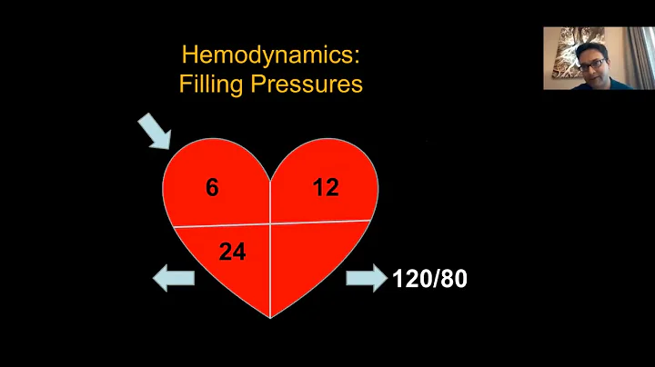 Cardiogenic Shock 101: Utilizing Hemodynamics in the Management of Cardiogenic Shock