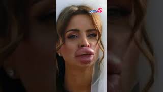 الفنانة نور اللبنانية وشها تشوه بسبب عملية تجميل