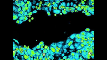 Wound Healing/Scratch Assay | JIMT-1 Breast Cancer Cells | HoloMonitor®