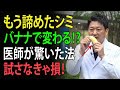 【皮膚科医が暴露】バナナの皮でシミが消える⁉老化の常識を覆す7習慣！ | 高齢者の健康