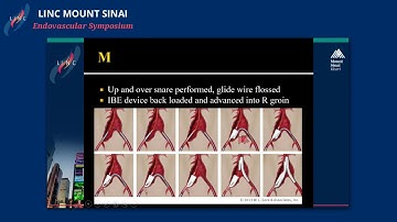 Complex Aortic Case Presentations Pt2